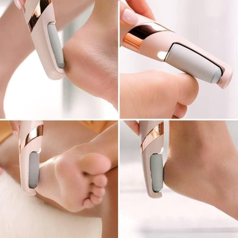 Rechargeable Callus Remover kit
